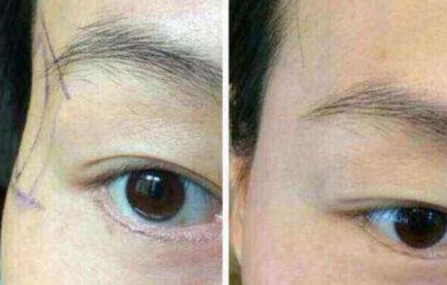 江蘇區(qū)整容醫(yī)院推薦：想在江蘇改頭換面的友人來(lái)看看這篇！高質(zhì)量美容機(jī)構(gòu)盤(pán)點(diǎn)提供參考