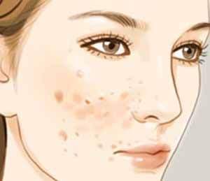 煙臺(tái)市內(nèi)著名雙眼皮整形醫(yī)院推薦【5所醫(yī)院】