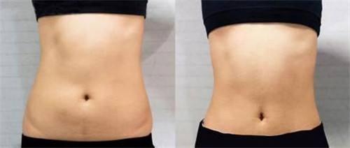 福州隆鼻整形醫(yī)生推薦匯總：專家升級(jí)，暢談口碑與擅長！