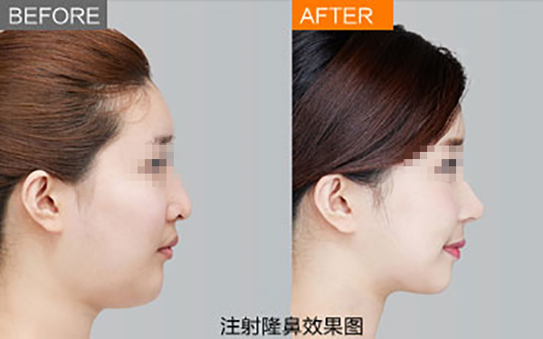 鄭州唇部整形醫(yī)院推薦：如何選擇合適的醫(yī)院？友友必看！