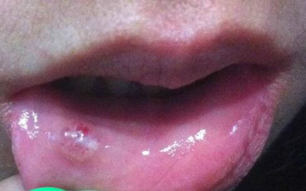 江蘇漏斗胸整形醫(yī)生