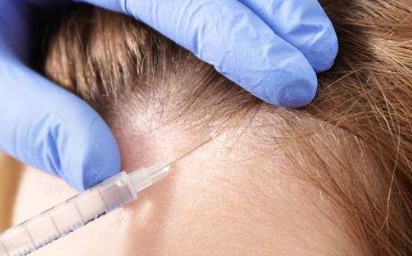 祛斑醫(yī)院推薦：打破斑點(diǎn)煩惱，找回美麗肌膚