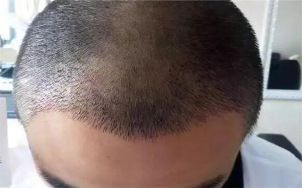 精選西安鼻子整形醫(yī)院榜單揭曉！美容專家推薦匯總單供您參考