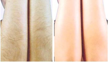 解放眼袋重害！揭秘成都頂尖醫(yī)療機(jī)構(gòu)眼袋技術(shù)