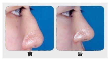 石家莊主要公立整形醫(yī)院排行榜！公辦醫(yī)療機構最具實力！