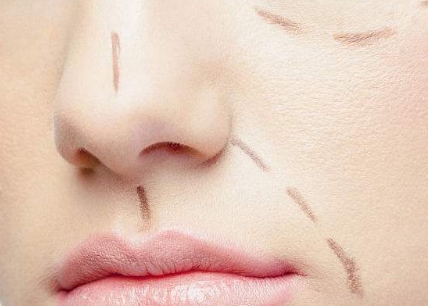 成都點(diǎn)陣射頻祛眼紋醫(yī)生