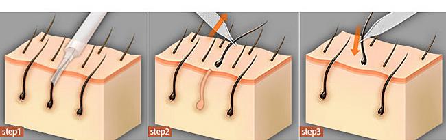 福州祛痣醫(yī)院推薦！快速了解前八家信譽(yù)口碑醫(yī)院