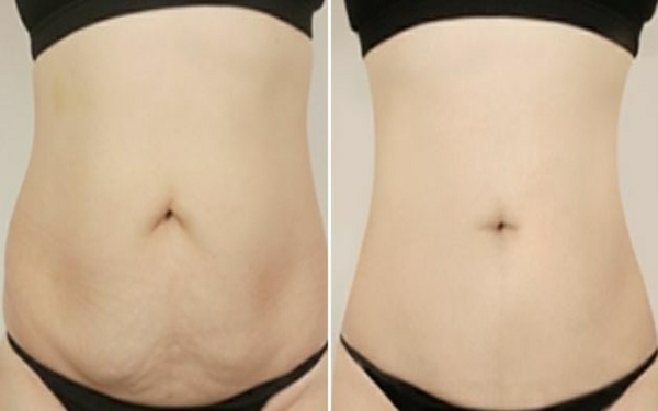 盤點溫州十佳隆鼻醫(yī)生，暢談鼻部整形專家與收費標準！