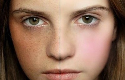 太原水光針去除動態(tài)細(xì)紋醫(yī)生