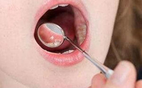 上海復合彩光嫩膚祛斑醫(yī)生