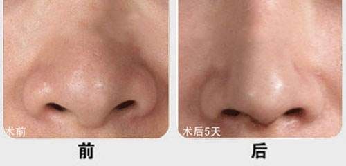 廈門市有哪些醫(yī)院提供優(yōu)質(zhì)的脂肪填充服務(wù)？江頭醫(yī)院、臉康整形醫(yī)院、美麗醫(yī)療中心等值得一看！快來(lái)了解一下