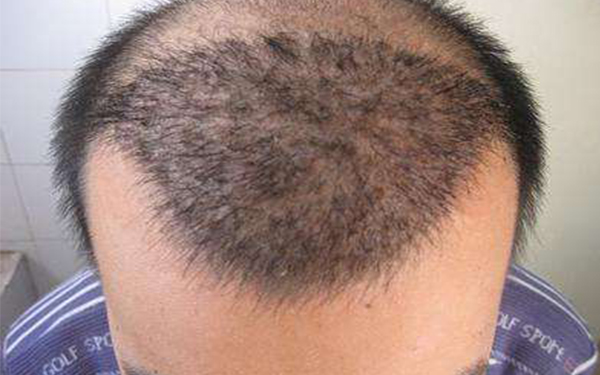 長(zhǎng)春三家牙齒整形醫(yī)院推薦：白求恩、段氏、華植等音譽(yù)卓著