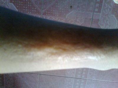 紹興耳軟骨隆鼻手術(shù)醫(yī)生