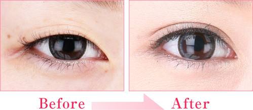 濟(jì)南激光治療老年斑醫(yī)生