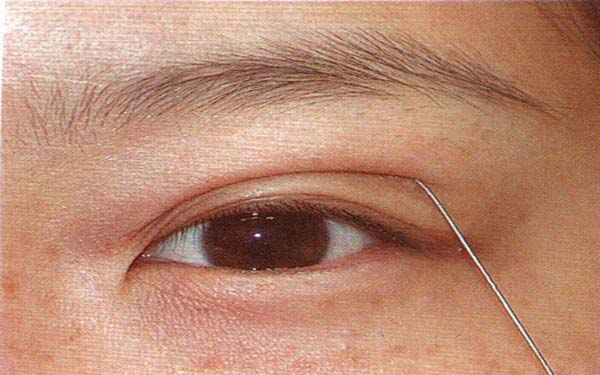 長沙五家醫(yī)院哪家提供優(yōu)質吸脂技術？推薦專業(yè)減重能手！