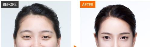 重慶最佳口腔?？漆t(yī)院排名公布！附牙齒矯正快速詢價攻略