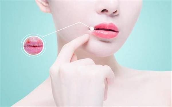 長(zhǎng)沙腿部做吸脂醫(yī)生