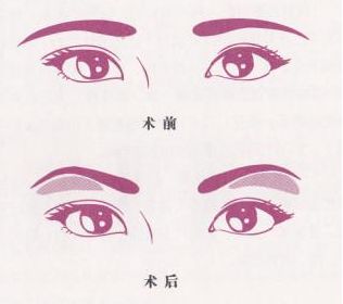 魅力煥發(fā)！常德市多家信譽(yù)醫(yī)院助你邁過疤痕困擾