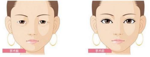 廣州注射隆頦哪家醫(yī)院效果較佳？2023前10位整形美容醫(yī)院哪家更權(quán)威？