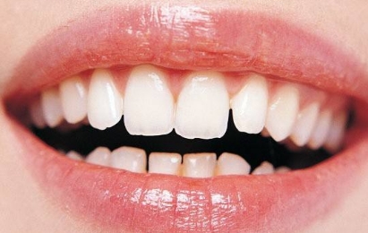 2023年，哪家醫(yī)院在武漢提供高質(zhì)量的無痕隆胸手術(shù)？