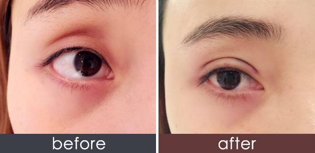 呼倫貝爾瑞藍(lán)除皺醫(yī)生