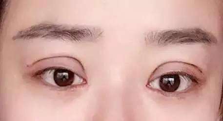 重慶男性面部除皺醫(yī)生