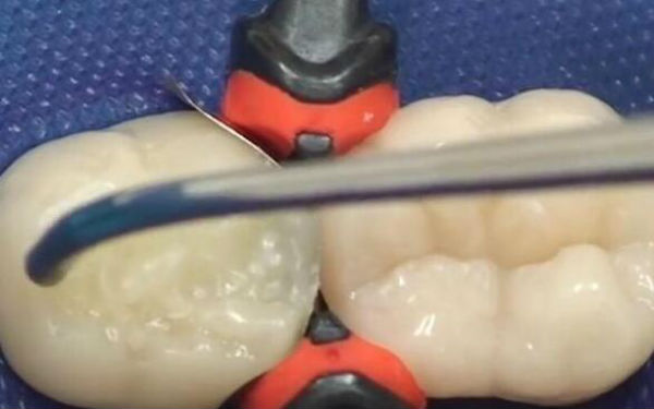 寧波下巴玻尿酸注射：2023年醫(yī)術(shù)精湛的醫(yī)院排行榜公布，這些整形醫(yī)院備受推崇！