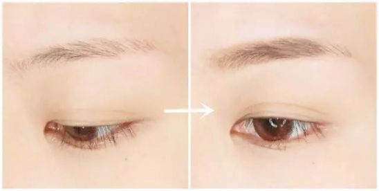 四川微針填充唇紋醫(yī)生