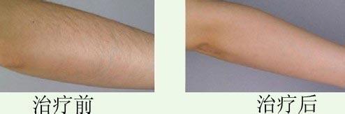 連云港哪些整形美容醫(yī)院在2023年在玻尿酸頸紋填充方面有口碑？十大排名新鮮出爐！