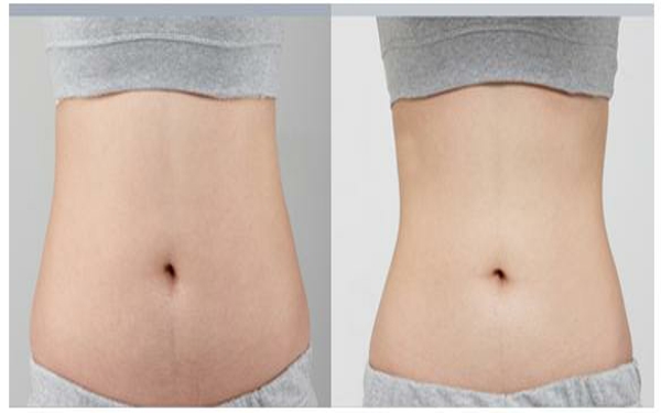 2023年貴陽(yáng)哪家雙眼皮整形醫(yī)院口碑，排名前10強(qiáng)整容美容醫(yī)院全揭秘