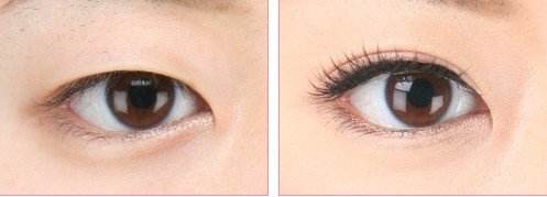 2023寧波面部提升美容排行：十家效果卓越的醫(yī)療整形醫(yī)院盤點(diǎn)