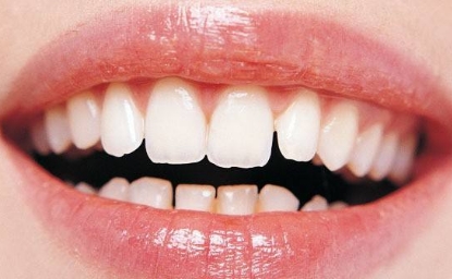 西安去頸部皺紋哪家醫(yī)院靠譜？2023西安提拉去頸部皺紋醫(yī)院十強(qiáng)榜單揭曉！