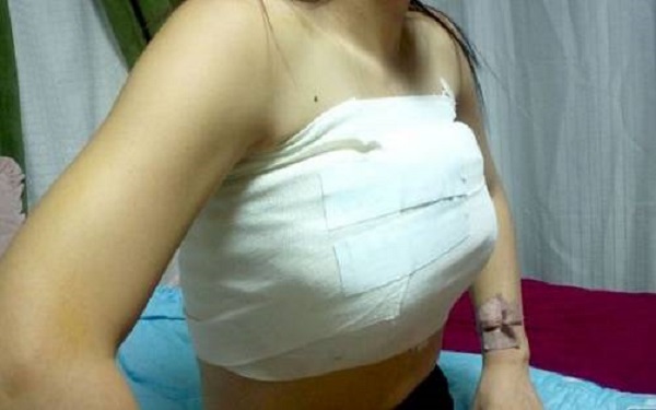 鄭州哪家整形醫(yī)院能讓您擁有完美豐唇？2023年排名前十的鄭州豐唇整形醫(yī)院是哪些？