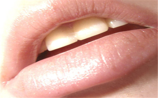 無錫面部改善醫(yī)生