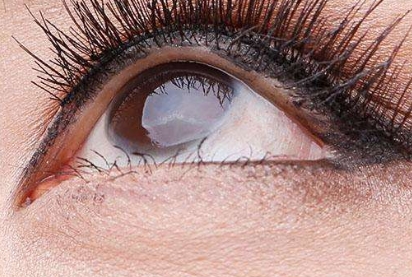 2023汕頭比較推崇的超皮秒祛斑醫(yī)療美容醫(yī)院排名前十強(qiáng)