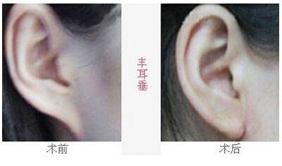 2023沈陽(yáng)去魚尾紋雕塑醫(yī)院排行榜，這十家都備受口碑推崇！