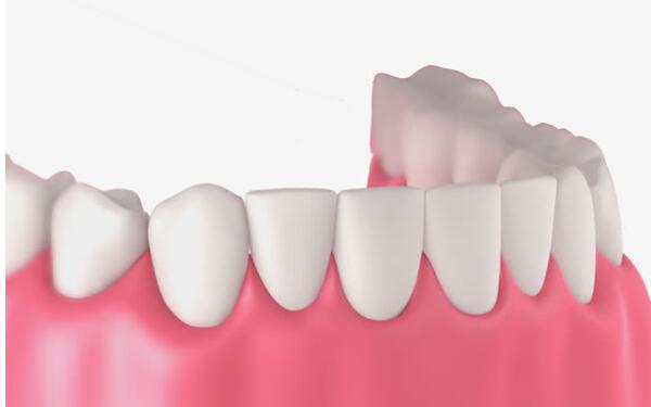 哪家南京整形醫(yī)院在川字紋脂肪填充方面效果突出？2023南京脂肪填充川字紋醫(yī)療前十強排行榜權(quán)威推薦！