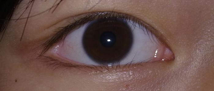 2023年浙江哪些醫(yī)院是值得去的提拉去眉間紋醫(yī)療美容醫(yī)院排名榜前十強(qiáng)詳解，實(shí)力解析！