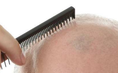 2023年度，沈陽整形美容醫(yī)院榜單公布！揭秘沈陽眾多醫(yī)院哪家豐下巴手術值得去