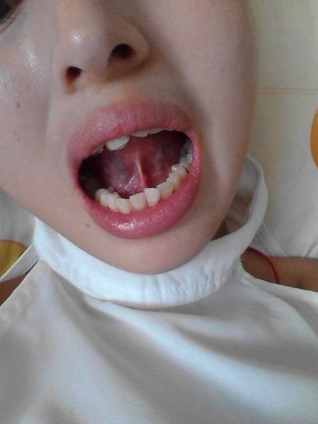 寧波botox除皺針醫(yī)生