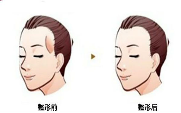 西寧顴骨矯正術(shù)：哪家醫(yī)院口碑好？2023年口碑排名前10的正規(guī)醫(yī)療整形醫(yī)院公布！