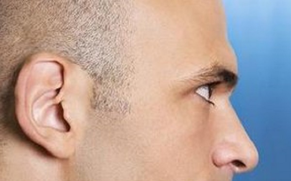 深圳哪幾家醫(yī)院能有效去除眼紋？2023年深圳比較好的眼紋去除醫(yī)院排名前十位解析！