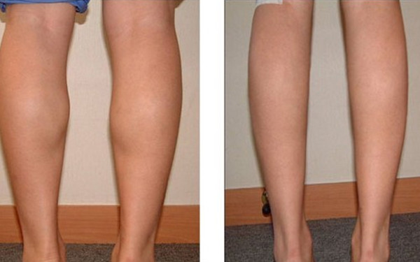 溫州面部奧美定：探尋2023年整形醫(yī)院排名！美容醫(yī)院揭曉，強(qiáng)烈熱推TOP10！