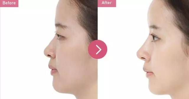 泰州眼紋打活細(xì)胞醫(yī)生