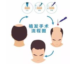 臺(tái)州哪里可以去除下眼皮皺紋？2023臺(tái)州排名前十的美容醫(yī)院推薦
