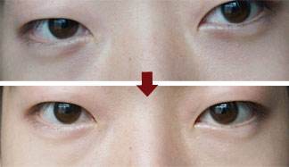 南京哪家醫(yī)院治療黃褐斑比較有口碑？2023南京微針美塑祛斑?？漆t(yī)院排行榜發(fā)布！