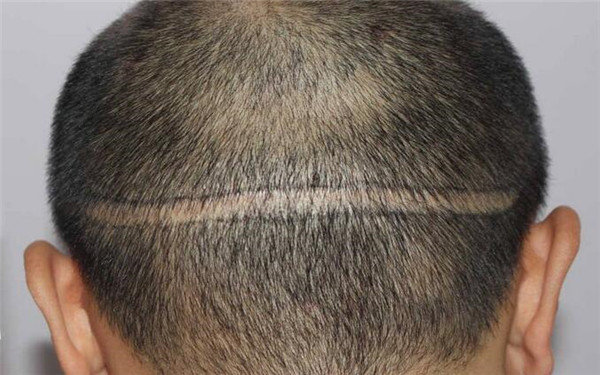 2023昆明眼部除皺手術(shù)—揭曉昆明眼部整形醫(yī)院排行榜！