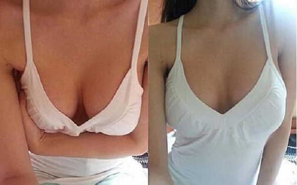 2023太原光子去咖啡斑治療醫(yī)院排行出爐！哪家醫(yī)院效果比較好