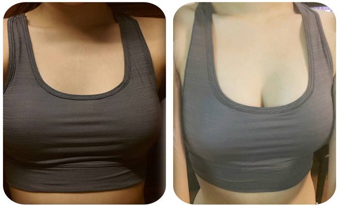 北京脂肪眼底紋填充醫(yī)生