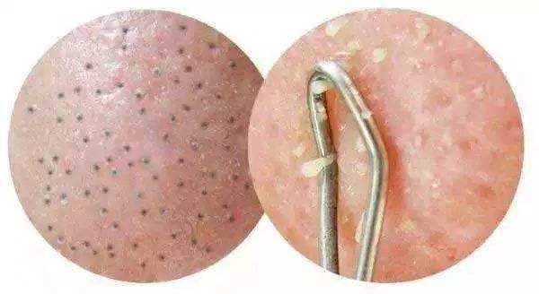 長(zhǎng)春無(wú)痕動(dòng)態(tài)隆胸醫(yī)生